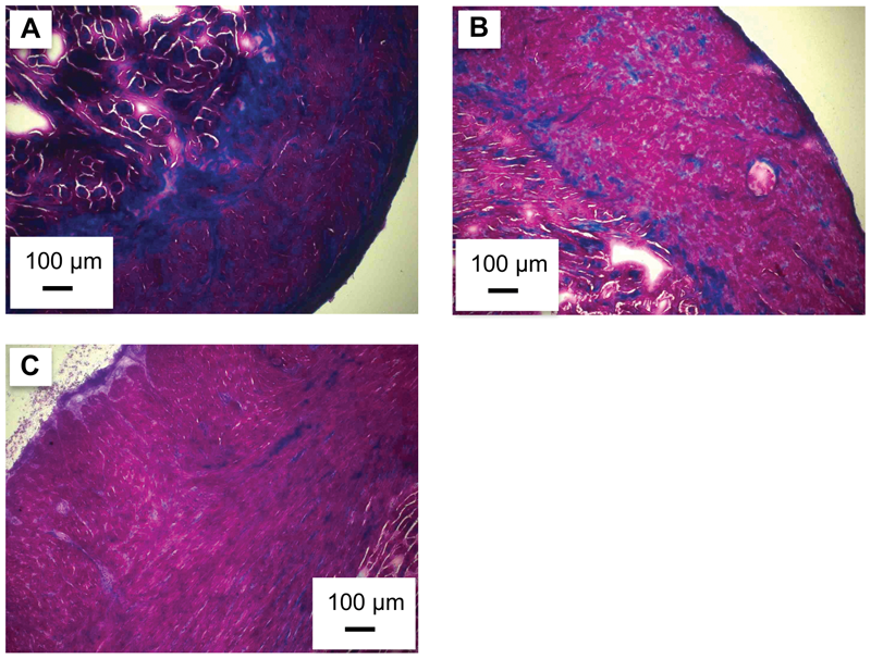 Influence of thermal acclimation on connective tissue content of the trout heart
