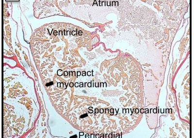 Temperature induced cardiac remodeling in fish